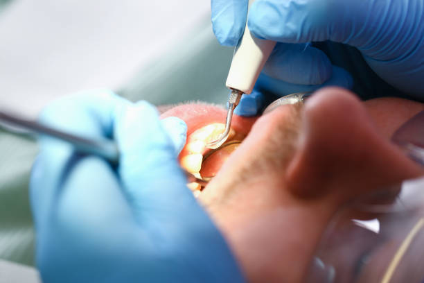 Best Walk-In Emergency Dentist in Weatherford, OK