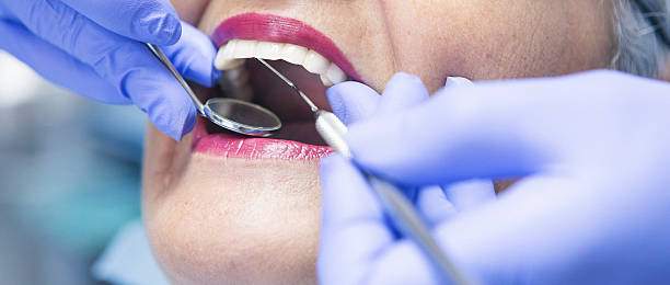 Best Emergency Tooth Extraction in Weatherford, OK