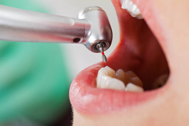 Best After-Hours Emergency Dentist in Weatherford, OK